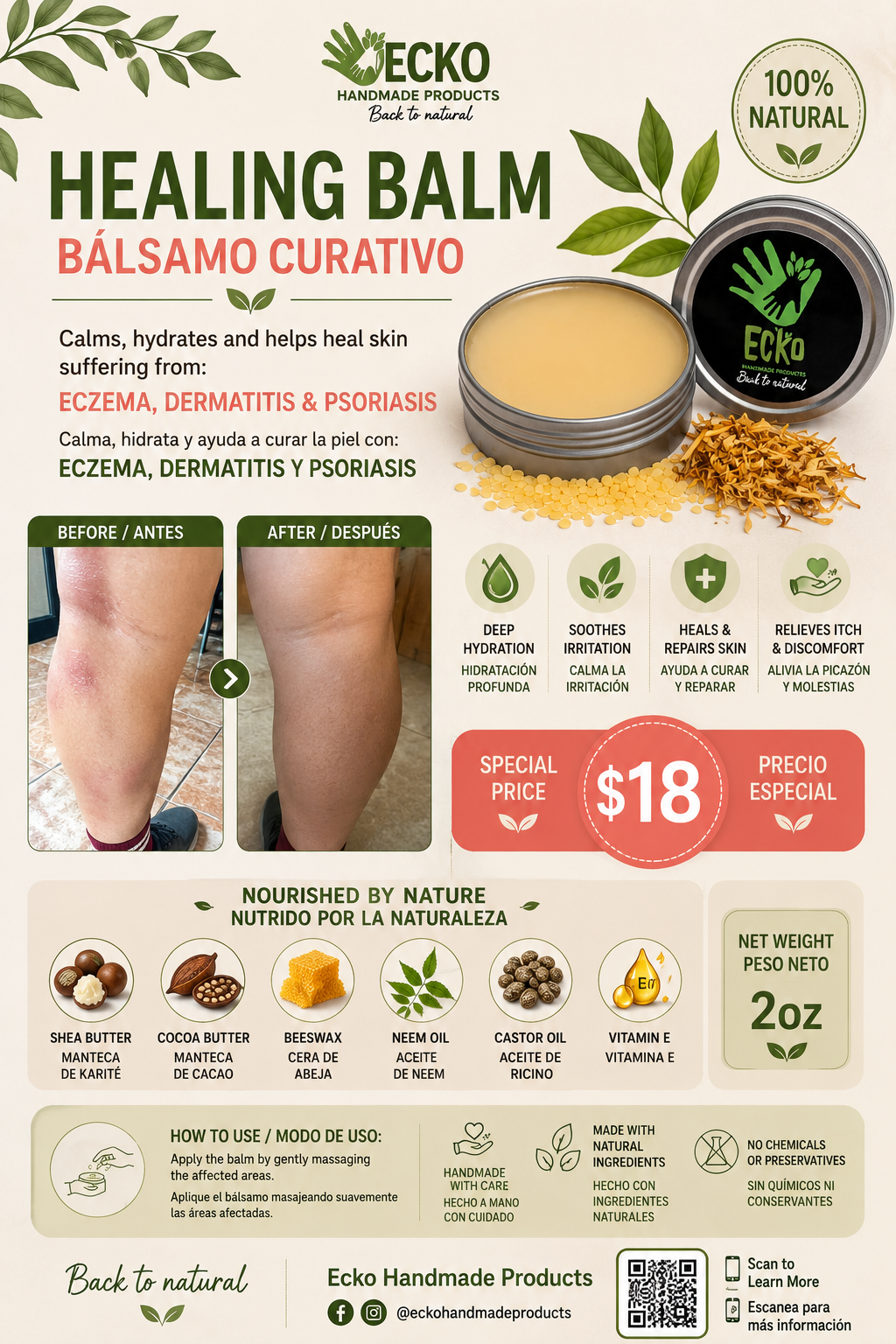 Healing Balm for Eczema, Dermatitis and Psoriasis